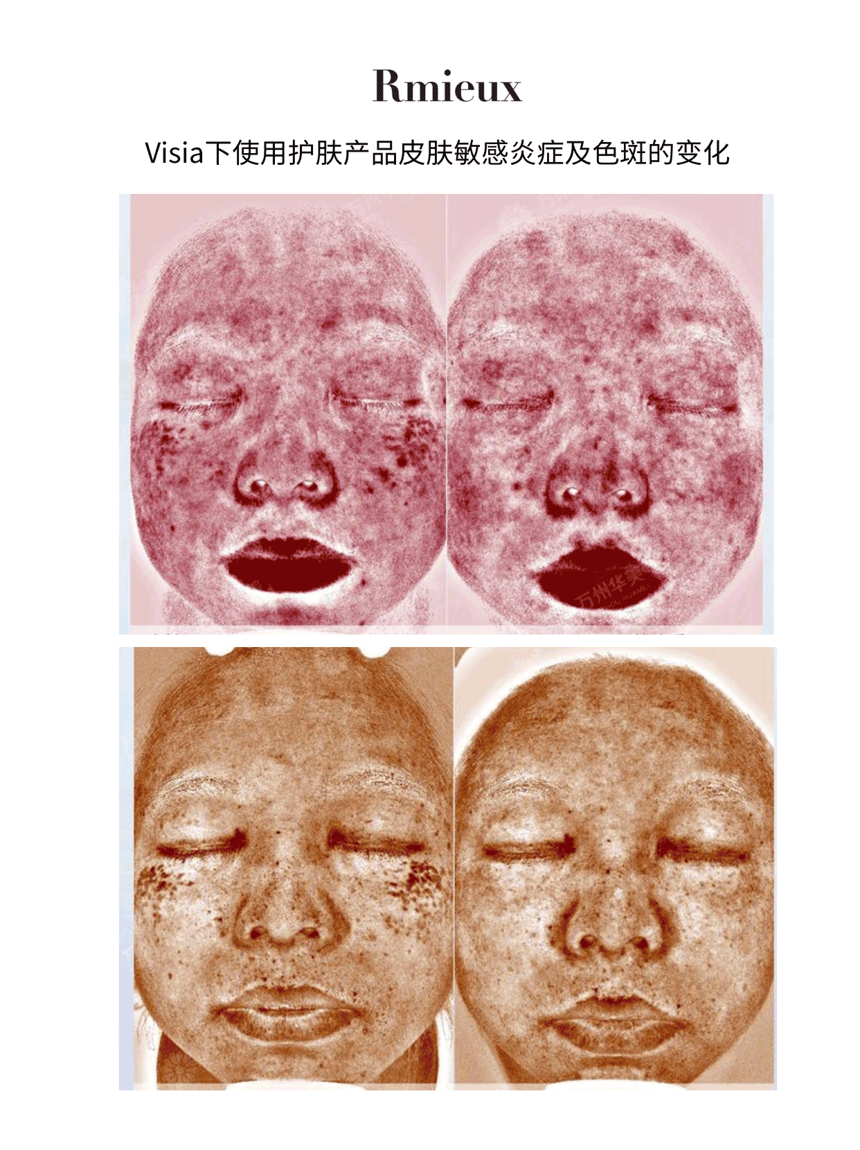 Rmieux Coefficient 8
